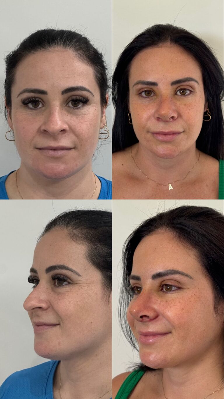 Resultado 7 dias