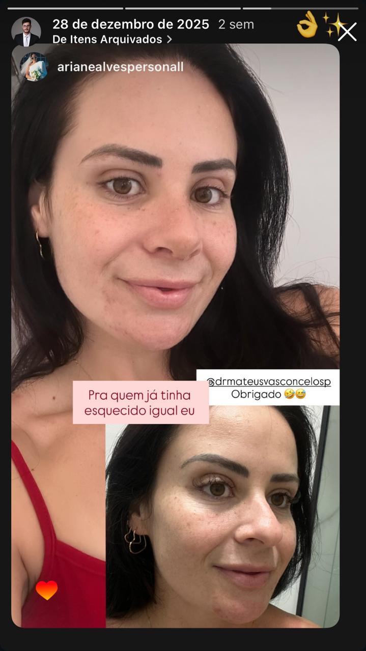 Antes e depois